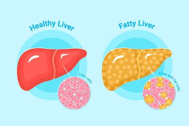 Understanding liver enzymes