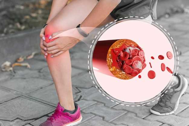 Atorvastatin induced myalgia