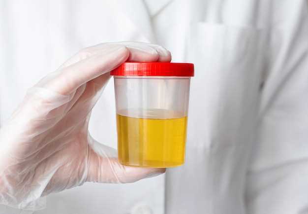 Atorvastatin yellow urine