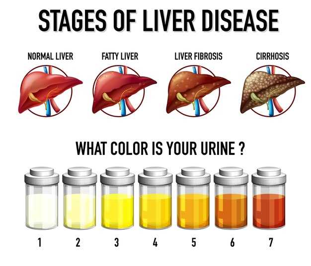 Effects of atorvastatin on the different phases of atherogenesis