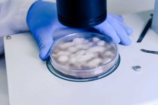 In vitro drug interaction studies of atorvastatin with ciprofloxacin gatifloxacin and ofloxacin